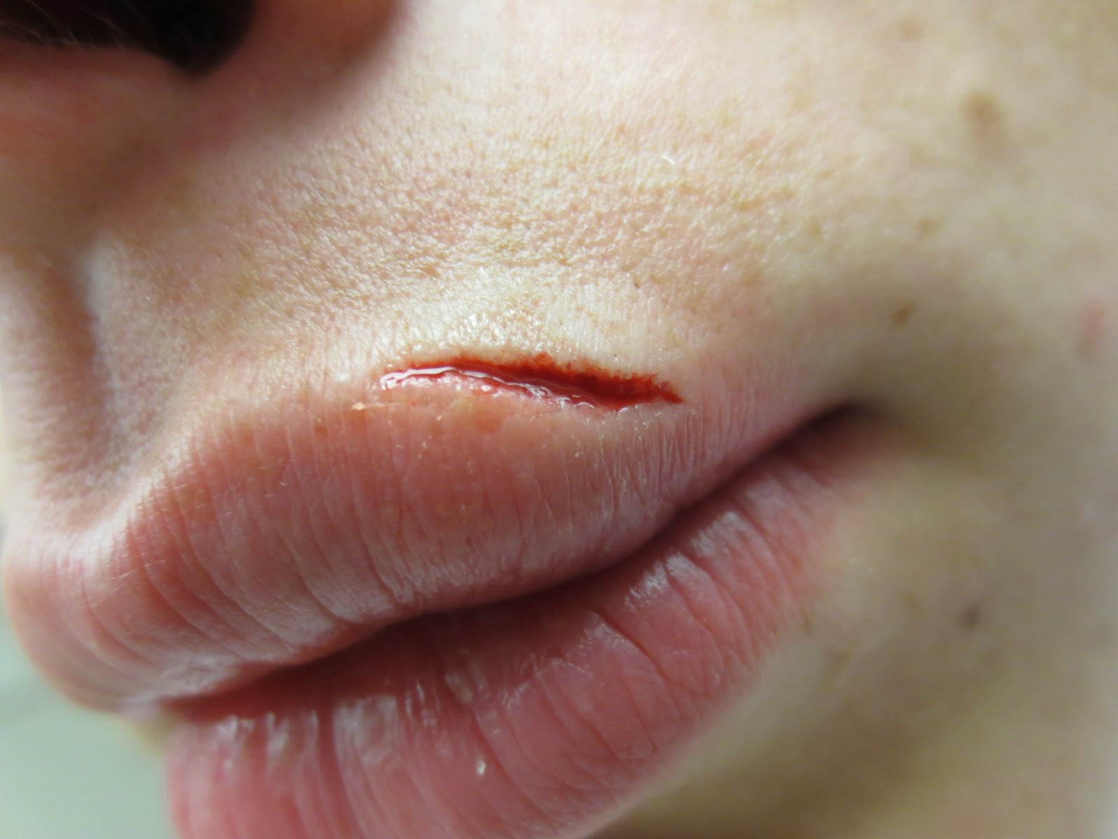 cut-on-lip