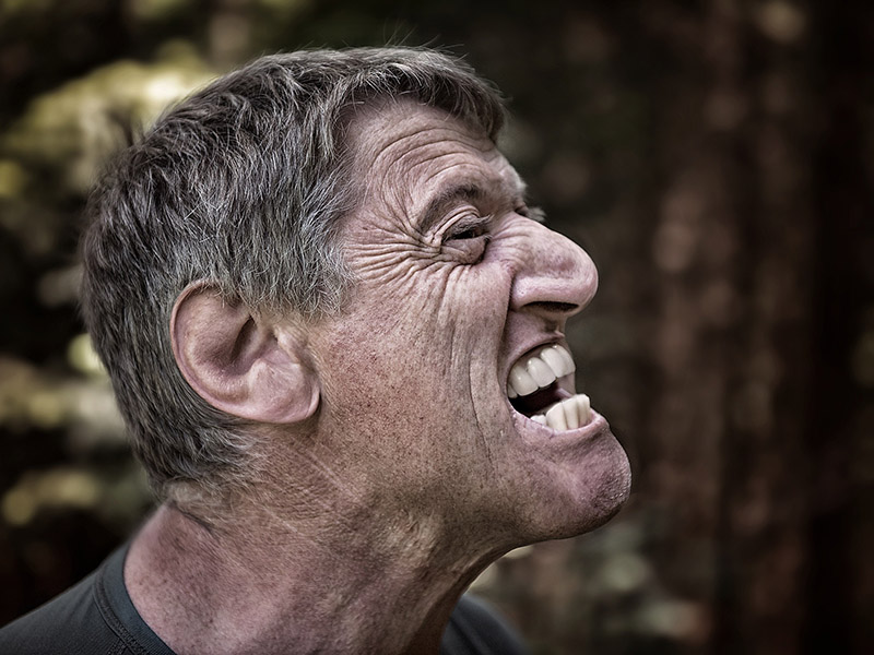 crooked-teeth-man