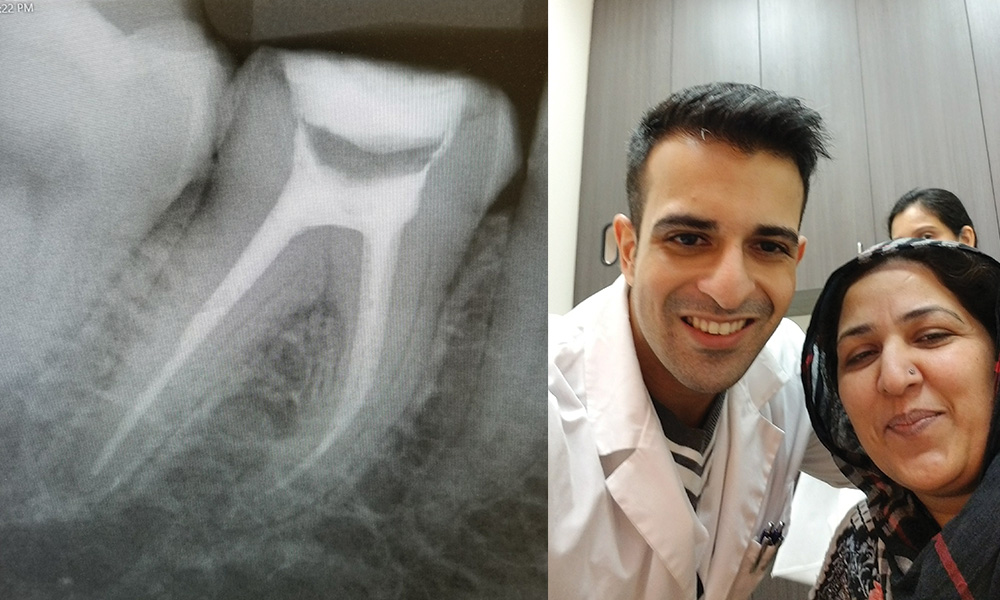root-canal-free-dental-clinic