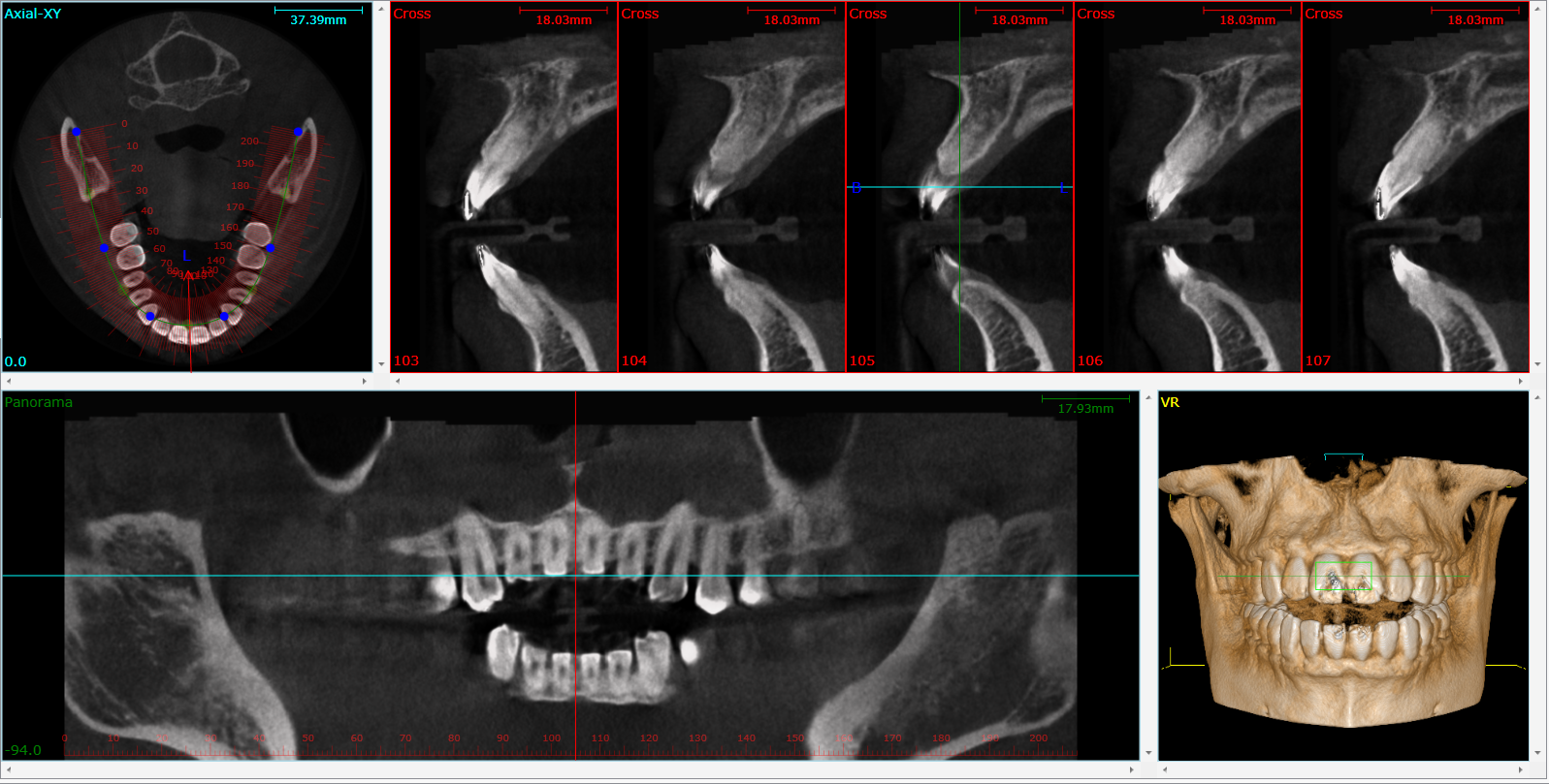cbct-xray